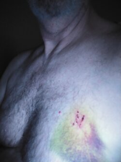 man boob damage.jpg