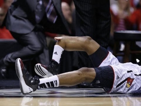 warebrokenleg.jpg