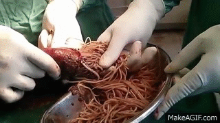 worm sign.gif