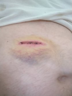 table saw damage part 2.jpg