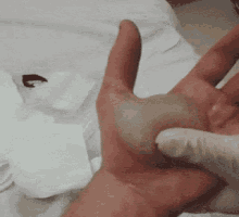 hand pimple.gif