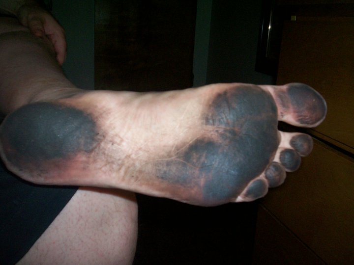 dirtyfoot.jpg